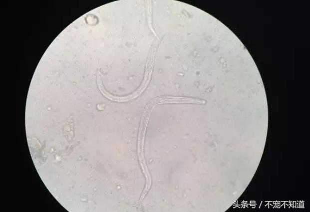 人感染犬钩虫怎么办,犬钩虫和蛔虫的区别