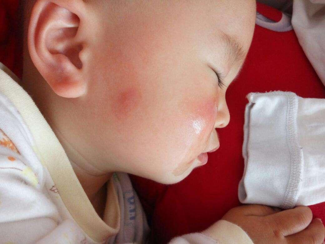 婴儿防蚊叮咬的小妙招,宝宝老是被蚊虫咬有什么驱蚊方法