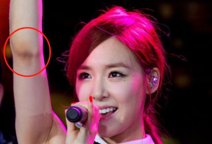 PP、腋下、手肘、三角区发黑暗沉？日本女*爱性**用好物，抹一抹，4周白嫩如少女！