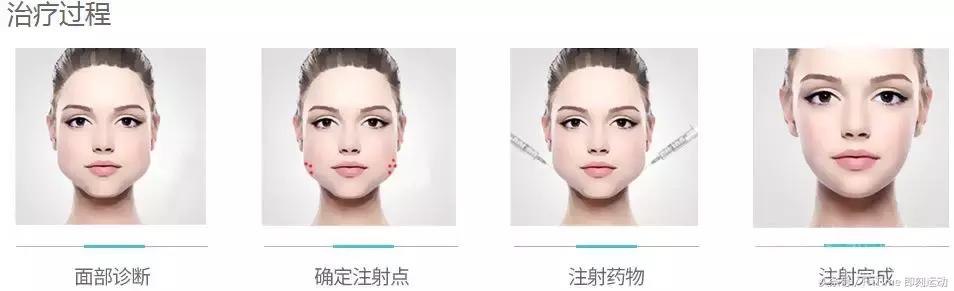 张雨绮瘦身成功训练图,张雨绮超声刀完整视频