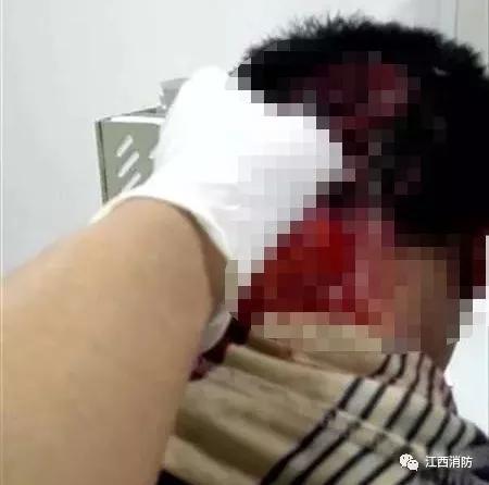 男子把手机放在枕头下面导致爆炸,男子睡觉时手机爆炸