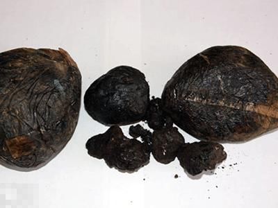 禁毒社区工作基础知识,禁毒知识宣传资料