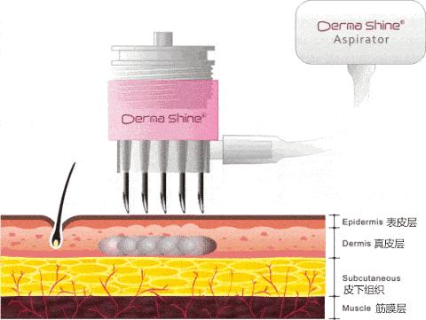 补充胶原蛋白肽的保健品有用吗,补充胶原蛋白用什么化妆品