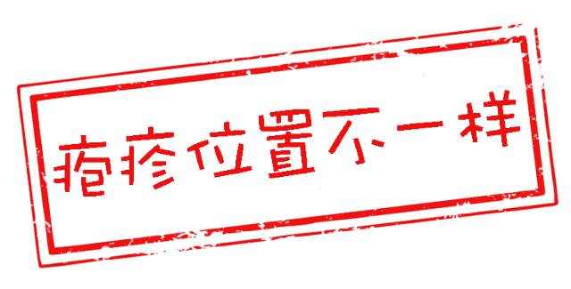 怎么区分水痘与手足口病,疱疹性咽峡炎和手足口病如何分别