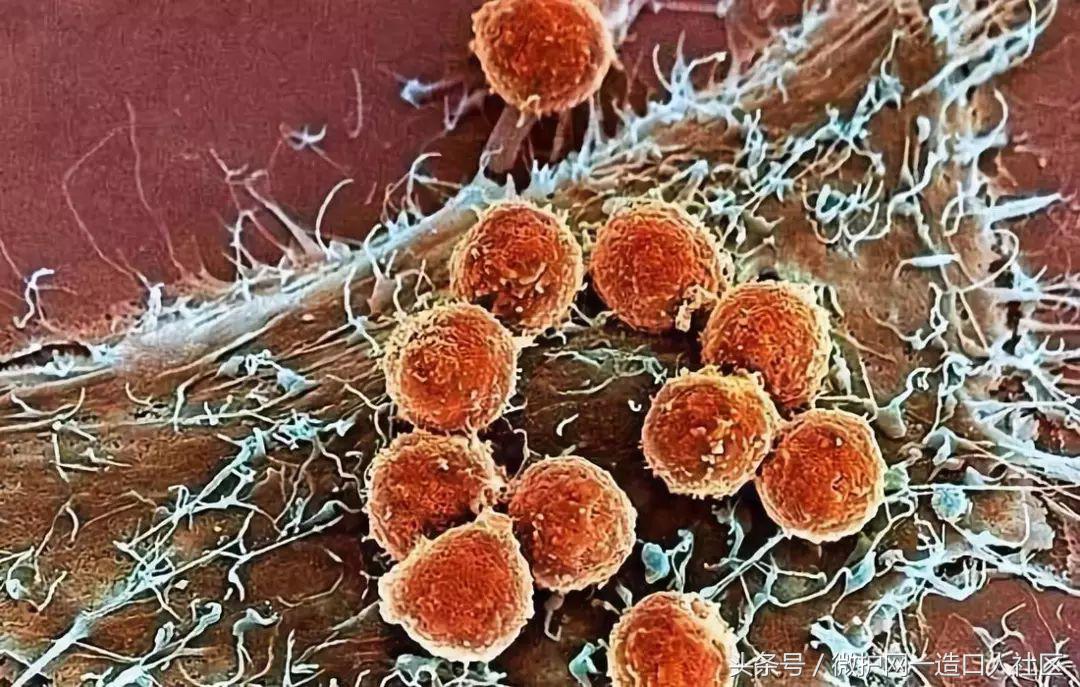 肠癌最新突破的治疗方法,中国治疗癌症重大突破设备