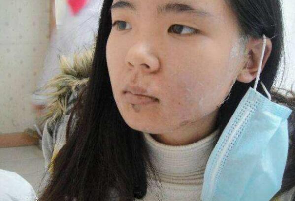 美白丸吃了真的可以美白吗,吃美白丸一般多久有效