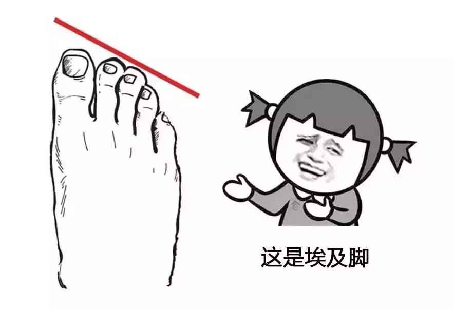 畸形脚型,看脚型分辨你适合穿怎样的鞋子