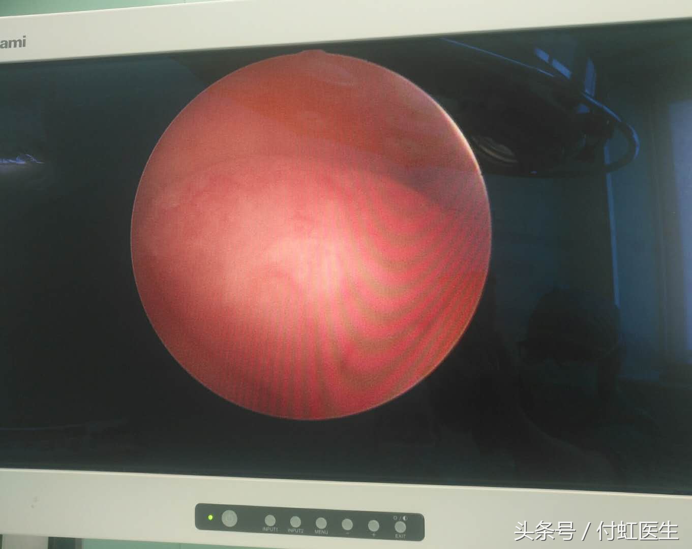 月经量多导致头晕身体发软,月经量多导致头晕头闷