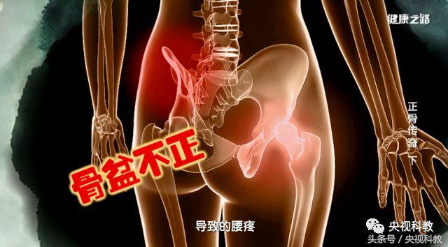中医正骨治疗腰疼视频,腰疼最快缓解方法躺床上正骨