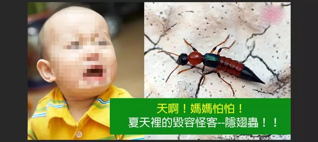 夏季到了,如何预防隐翅虫皮炎?