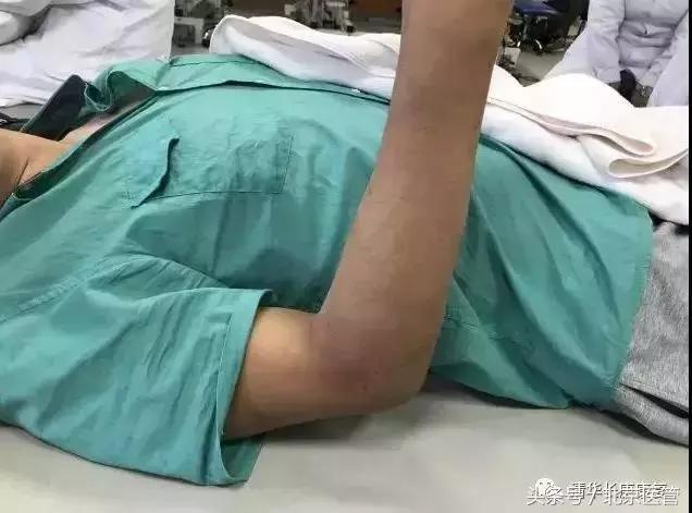 世界杯运动员损伤情况,世界杯球员受伤怎么处理