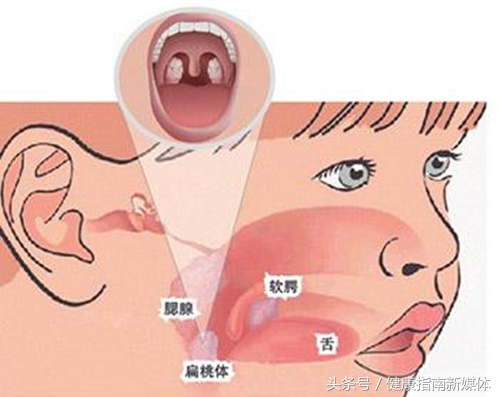 7岁小孩扁桃体肿大要切除吗,扁桃体2到3度肿大需要切除吗