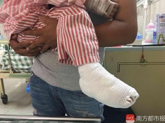 女子穿洞洞鞋脚被鞋划伤,小女孩穿洞洞鞋脚被卡在电梯内