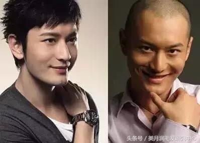 大额头怎么拥有完美发际线,发际线干货分享