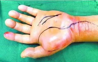 因体臭致飞机迫降,飞机最离谱的迫降原因