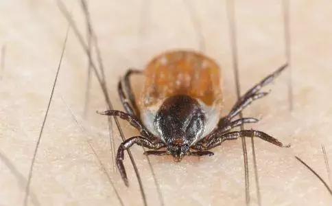 蜱虫咬人致死率多少,每年蜱虫咬人死亡率