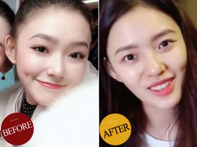 胶原蛋白肽张雨绮,张雨绮吐槽口服胶原蛋白