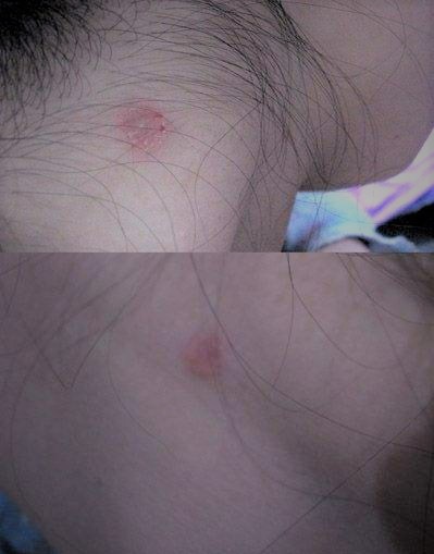 家里猫咪身上都是癣怎么办,家里猫咪得猫癣怎么消毒