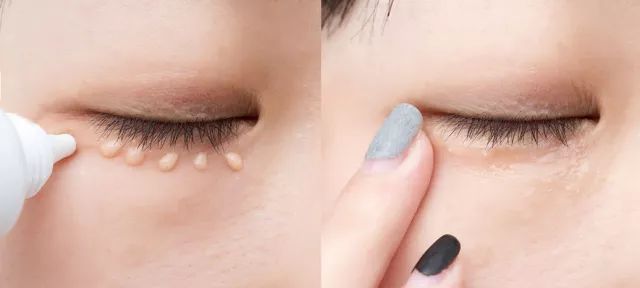 不用针挑手指扎进刺了怎么办,不用针挑就能挑出刺的方法