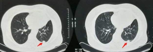 除了靶向免疫还有别的方法吗,除了靶向药还有什么方法治疗