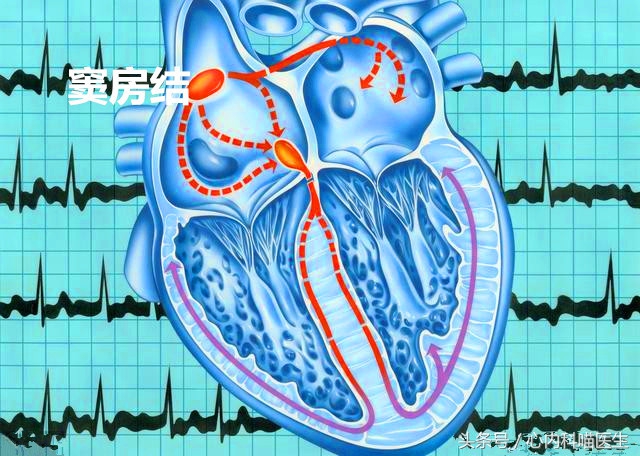 早搏需要怎么治疗需要注意什么,早搏有什么症状能治疗吗