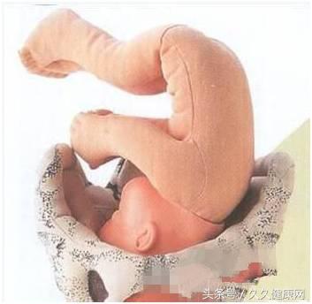 一般多少周胎头朝下,胎头朝下如何预防胎头朝上