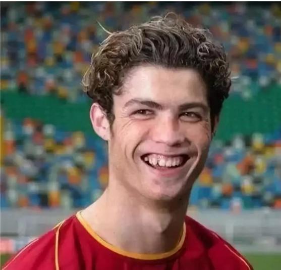 c罗整容过么,c罗整容了没