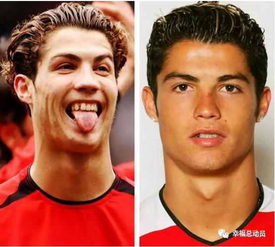 c罗整容过么,c罗整容了没