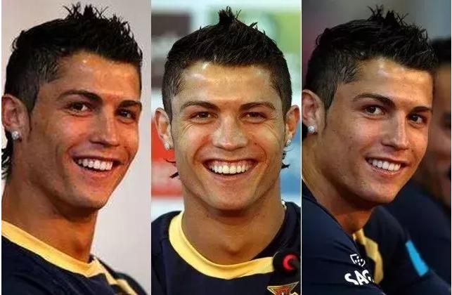 c罗整容过么,c罗整容了没