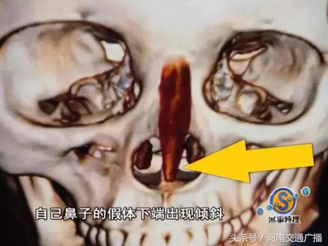 女子在整容医院整容失败当场死亡,整容失败女子医院讨说法被阻拦