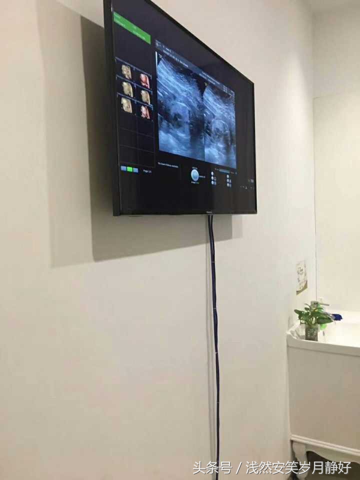 为什么做四维,和美家四维彩超临沂