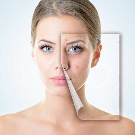 痘印反反复复去不掉,痘印一直去不掉