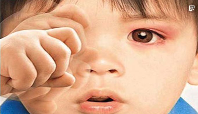 有效的眼部运动，常做这些动作可以减轻散光和改善视力