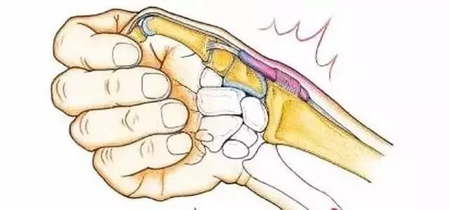 手残党的收藏,手残党必看