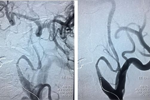 心血管内科急救流程,急诊静脉用药方法