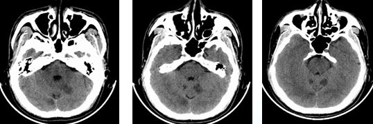 心血管内科急救流程,急诊静脉用药方法