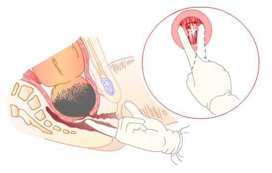 孕妇开五指到十指需要多久,孕妇开十指是什么意思