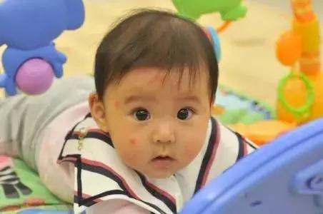 炉甘石乳膏是止痒的吗,无比滴止痒效果怎样