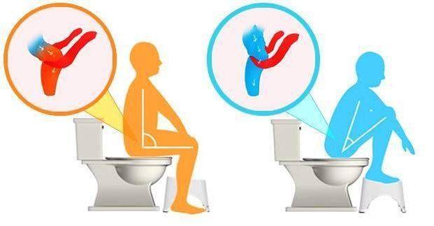为什么现在很多人都换了智能马桶,马桶边上要装个小便器好吗