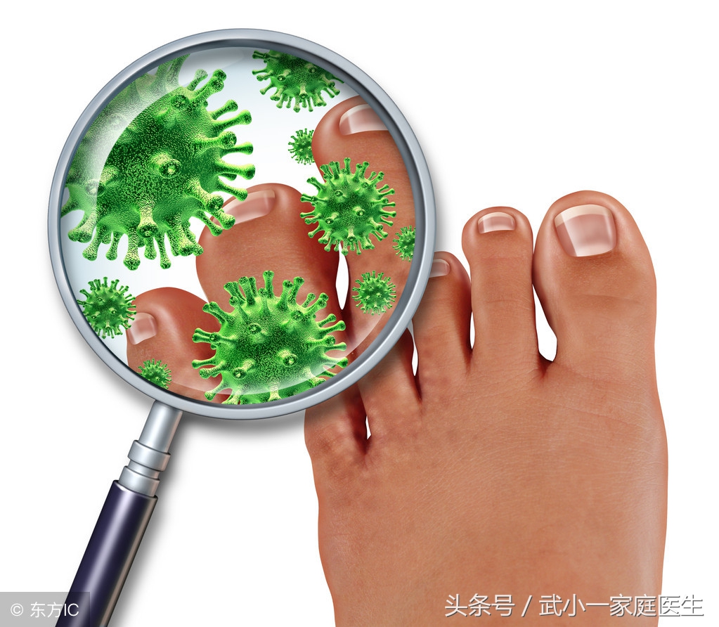 我终于战胜了懒惰,我终于战胜了牛皮癣