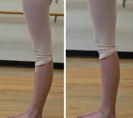 跑步膝关节小腿肌肉疼痛怎么恢复,跑步时膝盖疼伴随小腿酸