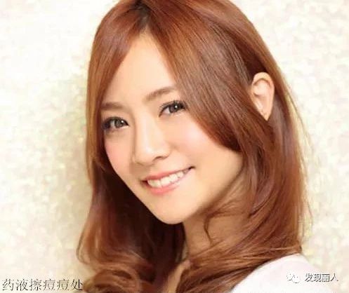 治疗青春痘的偏方小妙招,有没有特效药可以快速根治青春痘