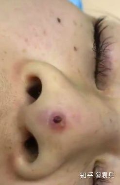 整形失败是不是就相当于毁容了,整形失败一般是在哪些地方