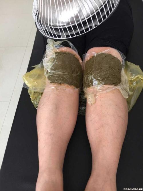 崴脚最快恢复上场,崴脚后还想打球怎么打绷带