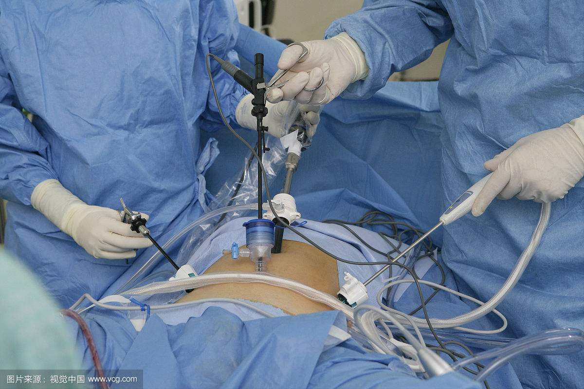 河北人民医院妇科子宫肌瘤专家,子宫肌瘤到底怎么样治才是最好的