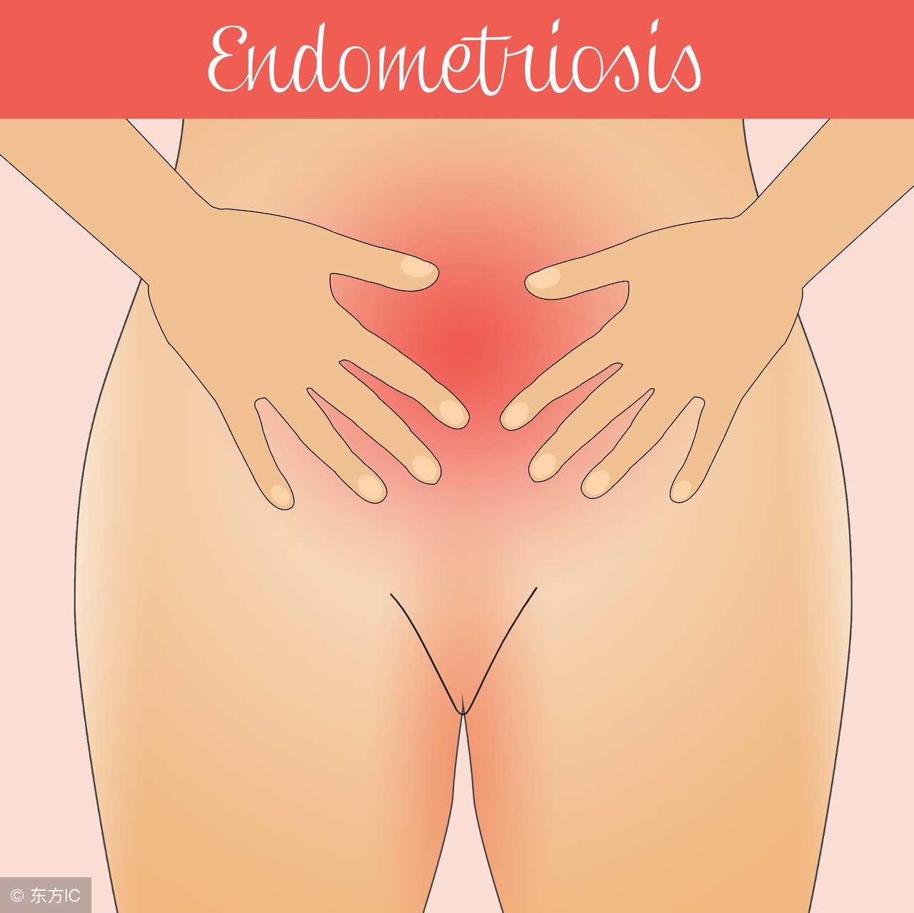 宫颈囊肿糜烂肥大影响怀孕吗,宫颈肥大影响排小便吗