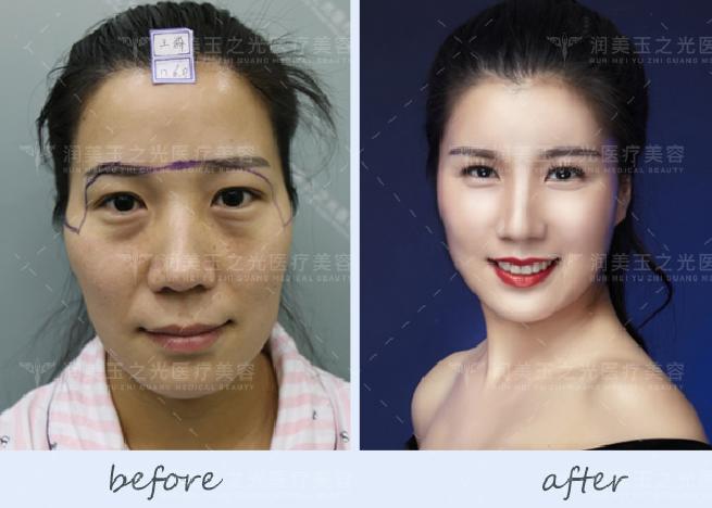 迪丽热巴现身发布会现场，发生了什么？「整形医生王明利」