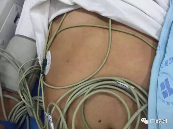 广西虫咬伤人,广西腿被虫咬伤