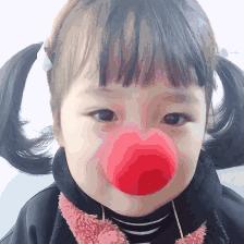 蒜头鼻怎么改变鼻型,蒜头鼻厚鼻翼怎么矫正