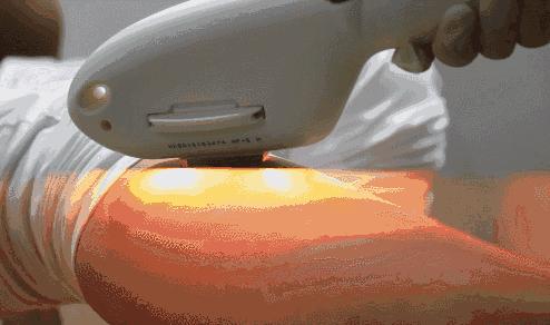 脱毛产品真人测评!这款岛国脱毛膏请绕行!